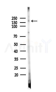 Phospho-CD227/MUC1 (Tyr1229) Antibody - Western blot analysis of lysates from HepG2 cells(starvation,24h treatment), using Phospho-CD227/MUC1 (Tyr1229) Antibody at 1/1000 dilution.