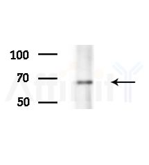 Phospho-FER (Tyr402) Antibody - Western blot analysis of lysates from Mouse brain, using Phospho-FER (Tyr402) Antibody at 1/1000 dilution.