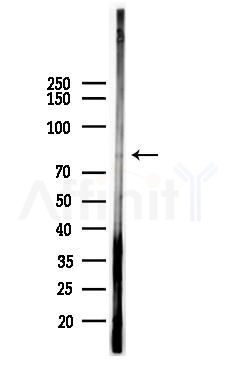 Phospho-FER (Tyr402) Antibody - Western blot analysis of lysates from Mouse brain, using Phospho-FER (Tyr402) Antibody at 1/1000 dilution.