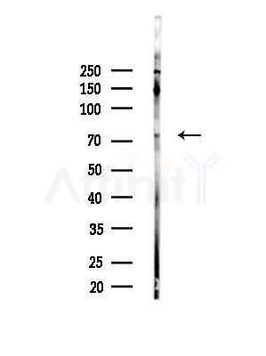 Phospho-PAK3 (Ser154) Antibody - Western blot analysis of lysates from 293 cells(LPS,4h treatment), using Phospho-PAK3 (Ser154) Antibody at 1/1000 dilution.