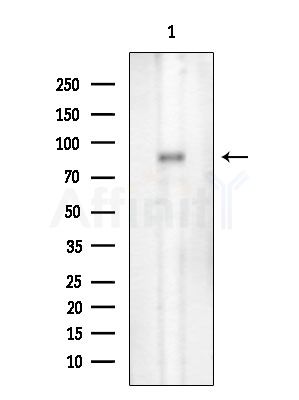 Phospho-EPS15 (Tyr849) Antibody - Western blot analysis of extracts from Rat testis, using Phospho-EPS15 (Tyr849) Antibody at 1/1000 dilution.