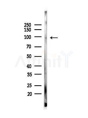 Phospho-EPS15 (Tyr849) Antibody - Western blot analysis of lysates from Rat testis, using Phospho-EPS15 (Tyr849) Antibody at 1/1000 dilution.