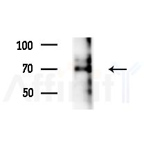 Phospho-Gab2 (Tyr452) Antibody - Western blot analysis of extracts from A375 cells(starvation treatment), using Phospho-Gab2 (Tyr452) Antibody at 1/1000 dilution.