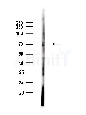 Phospho-Gab2 (Tyr452) Antibody - Western blot analysis of lysates from A375 cells(starvation,24h treatment), using Phospho-Gab2 (Tyr452) Antibody at 1/1000 dilution.