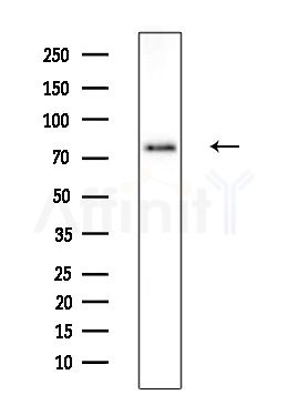 Phospho-5 Lipoxygenase (Ser523) Antibody - Western blot analysis of extracts from Rat brain, using Phospho-5 Lipoxygenase (Ser523) Antibody at 1/1000 dilution.