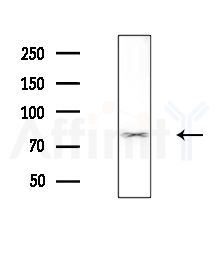 Phospho-5 Lipoxygenase (Ser523) Antibody - Western blot analysis of extracts from B16F10-HUC(heat-shock,45min treatment), using Phospho-5 Lipoxygenase (Ser523) Antibody at 1/1000 dilution.
