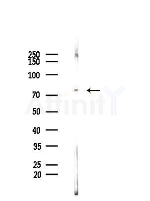 Phospho-5 Lipoxygenase (Ser523) Antibody - Western blot analysis of lysates from B16F10-HUC(heat-shock,45min treatment), using Phospho-5 Lipoxygenase (Ser523) Antibody at 1/1000 dilution.