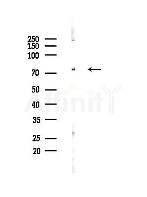 Phospho-5 Lipoxygenase (Ser523) Antibody - Western blot analysis of lysates from Rat brain, using Phospho-5 Lipoxygenase (Ser523) Antibody at 1/1000 dilution.