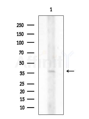 CD226/DNAM-1 Antibody - Western blot analysis of extracts from COLO205 cells, using CD226/DNAM-1 Antibody at 1/1000 dilution.