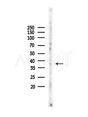 CD226/DNAM-1 Antibody - Western blot analysis of lysates from COLO205 cells, using CD226/DNAM-1 Antibody at 1/1000 dilution.