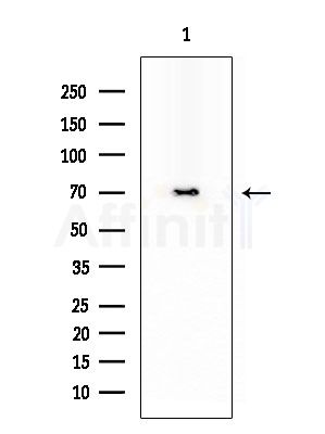 FRS2 Antibody - Western blot analysis of extracts from COLO205 cells, using FRS2 Antibody at 1/1000 dilution.