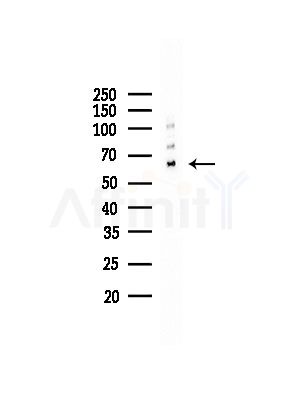 FRS2 Antibody - Western blot analysis of lysates from COLO205 cells, using FRS2 Antibody at 1/1000 dilution.