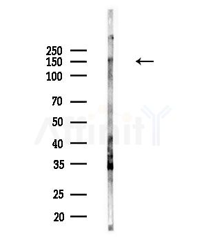 RON Antibody - Western blot analysis of lysates from PC12 cells(LPS,4h treatment), using RON Antibody at 1/1000 dilution.