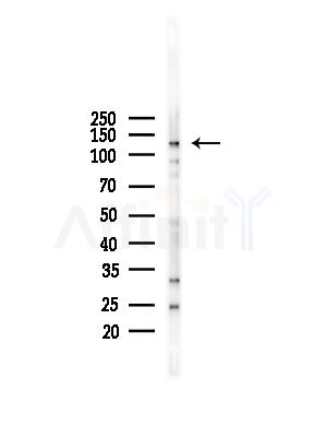 CARD6 Antibody - Western blot analysis of lysates from LoVo cells(heat-shock,45min treatment), using CARD6 Antibody at 1/1000 dilution.