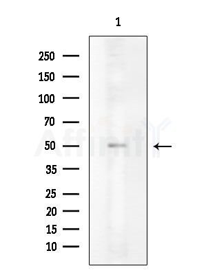 Collagen II Antibody - Western blot analysis of extracts from EC304 cells, using Collagen II Antibody at 1/1000 dilution.