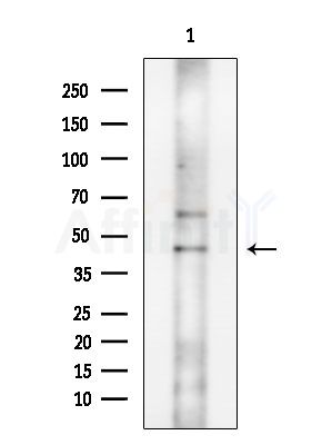 Collagen II Antibody - Western blot analysis of extracts from 293 cells(LPS 4h treatment), using Collagen II Antibody at 1/1000 dilution.
