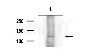 Collagen II Antibody - Western blot analysis of extracts from MCF7 cells(heat-shock treatment), using Collagen II Antibody at 1/1000 dilution.