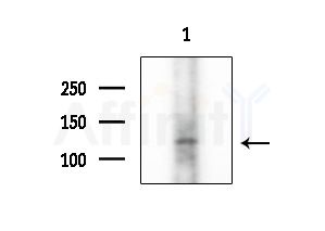 Collagen II Antibody - Western blot analysis of extracts from B16F10-LUC cells, using Collagen II Antibody at 1/1000 dilution.