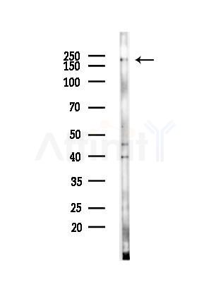 Collagen II Antibody - Western blot analysis of lysates from 293 cells(LPS,4h treatment), using Collagen II Antibody at 1/1000 dilution.