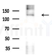 Collagen III Antibody - Western blot analysis of lysates from Mouse liver, using Collagen III Antibody at 1/1000 dilution.