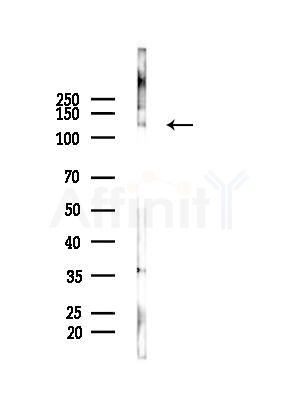 Collagen III Antibody - Western blot analysis of lysates from Mouse liver, using Collagen III Antibody at 1/1000 dilution.