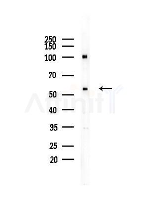 Cyclin A Antibody - Western blot analysis of lysates from EC304 cells, using Cyclin A Antibody at 1/1000 dilution.