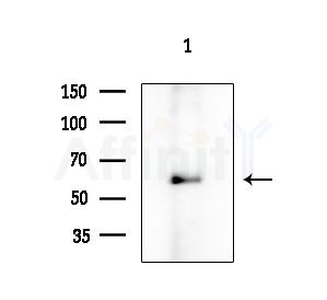 Cyclin A1 Antibody - Western blot analysis of extracts from EC304 cells, using Cyclin A1 Antibody at 1/1000 dilution.