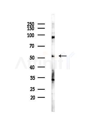Cyclin A1 Antibody - Western blot analysis of lysates from EC304 cells, using Cyclin A1 Antibody at 1/1000 dilution.