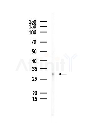 Cyclin G Antibody - Western blot analysis of lysates from EC304 cells, using Cyclin G Antibody at 1/1000 dilution.