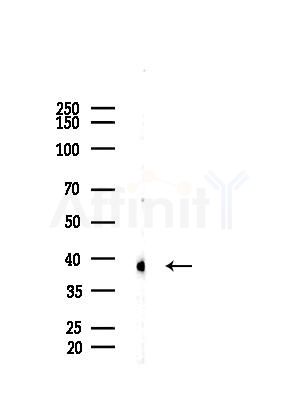 DNA Polymerase beta Antibody - Western blot analysis of lysates from B16F10-HUC(heat-shock treatment), using DNA Polymerase beta Antibody at 1/1000 dilution.