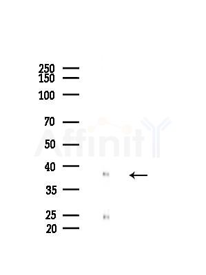 DNA Polymerase beta Antibody - Western blot analysis of lysates from Mouse liver, using DNA Polymerase beta Antibody at 1/1000 dilution.