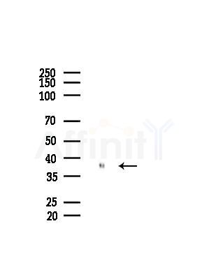 DNA Polymerase beta Antibody - Western blot analysis of lysates from HepG2 cells(starvation treatment), using DNA Polymerase beta Antibody at 1/1000 dilution.