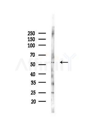 TFDP1 Antibody - Western blot analysis of lysates from PC12 cells(LPS, 4h treatment), using TFDP1 Antibody at 1/1000 dilution.