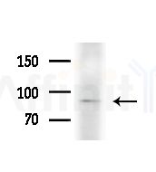 mGluR2/3 Antibody - Western blot analysis of lysates from PC12 cells(LPS,4h treatment), using mGluR2/3 Antibody at 1/1000 dilution.