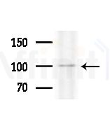 mGluR2/3 Antibody - Western blot analysis of lysates from HepG2 cells(heat-shock treatment), using mGluR2/3 Antibody at 1/1000 dilution.
