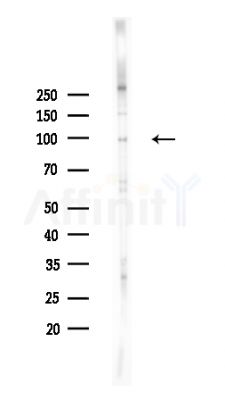 mGluR2/3 Antibody - Western blot analysis of lysates from HepG2 cells(heat-shock,45min treatment), using mGluR2/3 Antibody at 1/1000 dilution.