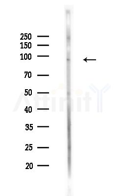 mGluR2/3 Antibody - Western blot analysis of lysates from PC12 cells(LPS,4h treatment), using mGluR2/3 Antibody at 1/1000 dilution.