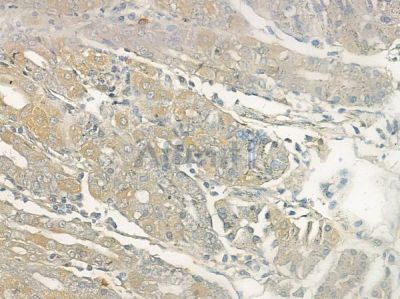 GLUT3 Antibody - AF0174 at 1/100 staining human normal colon tissue by IHC-P.