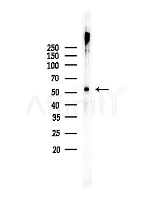 GLUT3 Antibody - Western blot analysis of lysates from COLO205 cells, using GLUT3 Antibody at 1/1000 dilution.