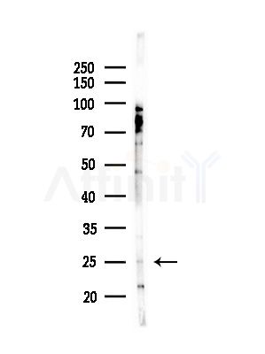 Granzyme B/H Antibody - Western blot analysis of lysates from Hela cells(starvation,24h treatment), using Granzyme B/H Antibody at 1/1000 dilution.