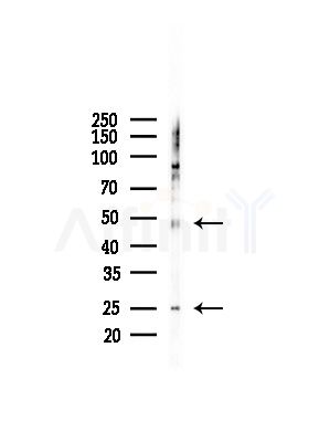 Granzyme B/H Antibody - Western blot analysis of lysates from LoVo cells(heat-shock,45min treatment), using Granzyme B/H Antibody at 1/1000 dilution.