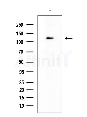 HDAC9 Antibody - Western blot analysis of extracts from COLO205 cells, using HDAC9 Antibody at 1/1000 dilution.