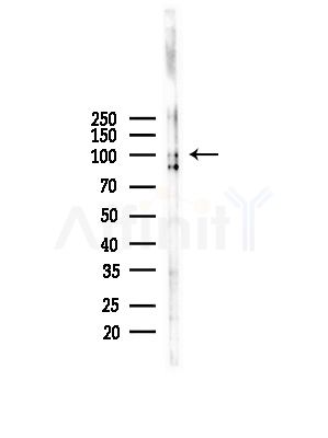 Integrin beta 5 Antibody - Western blot analysis of lysates from LoVo cells(heat-shock,45min treatment), using Integrin beta 5 Antibody at 1/1000 dilution.
