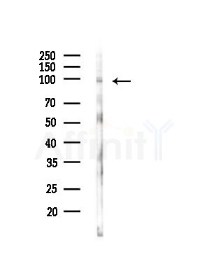 Involucrin Antibody - Western blot analysis of lysates from RAW264.