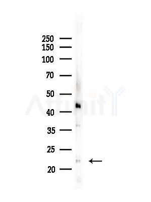 JM4 Antibody - Western blot analysis of lysates from Hela cells(starvation,24h treatment), using JM4 Antibody at 1/1000 dilution.