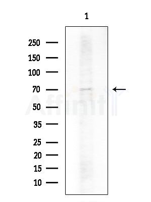 Cytokeratin 16 Antibody - Western blot analysis of extracts from COLO205 cells, using Cytokeratin 16 Antibody at 1/1000 dilution.