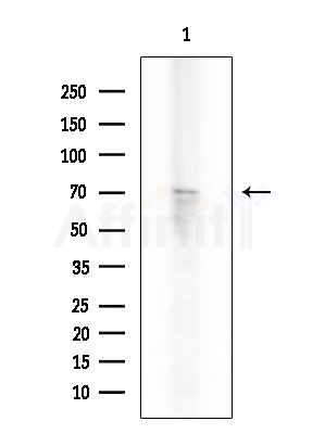Cytokeratin 16 Antibody - Western blot analysis of extracts from Rat testis, using Cytokeratin 16 Antibody at 1/1000 dilution.