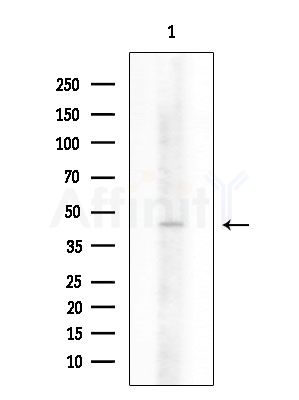 Cytokeratin 16 Antibody - Western blot analysis of extracts from Mouse lung, using Cytokeratin 16 Antibody at 1/1000 dilution.