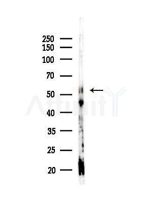 Cytokeratin 10 Antibody - Western blot analysis of lysates from Hela cells(starvation,24h treatment), using Cytokeratin 10 Antibody at 1/1000 dilution.