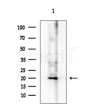 MLANA Antibody - Western blot analysis of lysates from 293 cells(LPS 4h treatment), using MLANA Antibody at 1/1000 dilution.